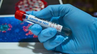 Свыше 32 тысяч петербуржцев обследовали на коронавирус за сутки