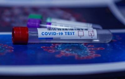 Ученые из Оксфорда разработали новый "пятиминутный" тест на коронавирус