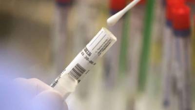 В Германии новый антирекорд: за сутки коронавирусом заболело 7830 человек