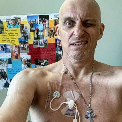 Тиньков рассказал о своём состоянии после пересадки костного мозга