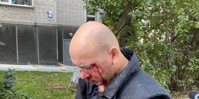 В центре Киева избили ветерана АТО Деева, которого в декабре прошлого года освободили из плена