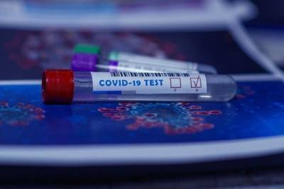 Ученые создали рекордно быстрый тест на коронавирус