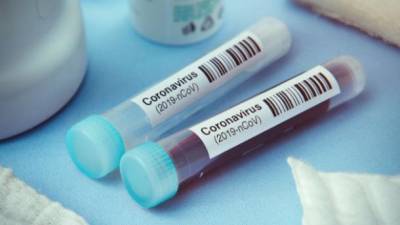 В Украине за сутки зафиксировано 5231 новый случай заражения коронавирусом