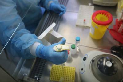В Волгоградской области зафиксировано 175 новых случаев коронавируса