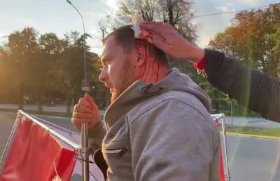 В Кременчуге кандидату от Партии Шария арматурой разбили голову