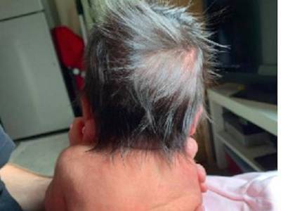 Необычные волосы новорожденной малышки вызвали шок