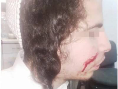 В Умани напали на подростков хасидов: у одного парня ножевое раненение