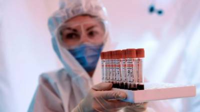 На Украине за сутки выявили 4766 новых случаев коронавируса