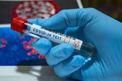 За сутки в Украине подтвердили 4 766 новых случаев коронавируса