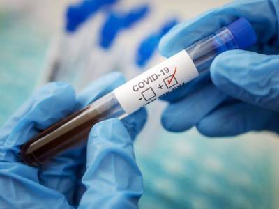 На Луганщине зафиксирована еще одна смерть от коронавируса: статистика заболеваемости