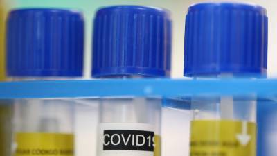 В Молдавии за сутки выявили 252 новых случая коронавируса