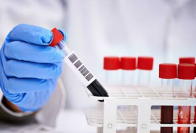 В Ленобласти за сутки выявлено 77 новых случаев коронавируса