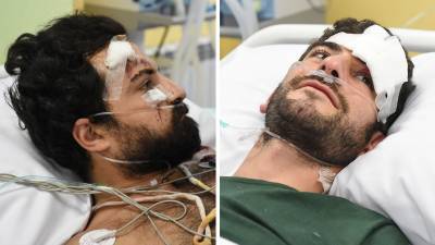 Раненных в Карабахе французских журналистов эвакуировали спецбортом
