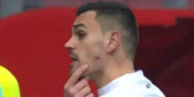 Голкипер французского клуба обвинил футболиста соперника в укусе за щеку — видео