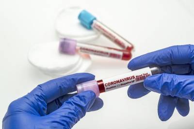 В Украине за минувшие сутки обнаружили 5469 новых случаев коронавируса COVID-19