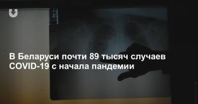 В Беларуси почти 89 тысяч случаев COVID-19 с начала пандемии
