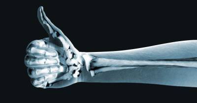Ученые из Томска улучшили титановые имплантаты для костей