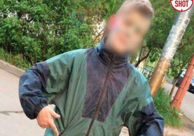 В Лобне школьник погиб при взрыве снаряда времен ВОВ - ya62.ru