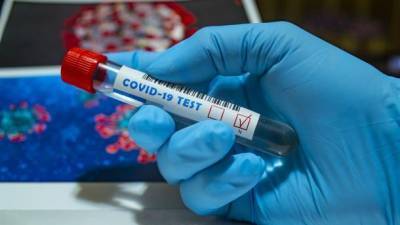 В Украине в течение суток - 6719 новых заражений коронавирусом, 141 человек умер