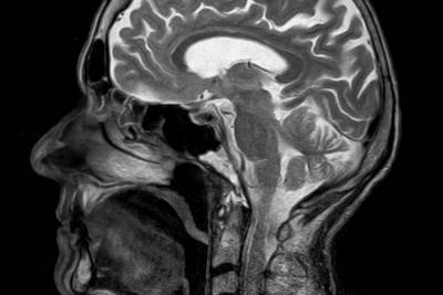 Ученые нашли в голове человека новый орган