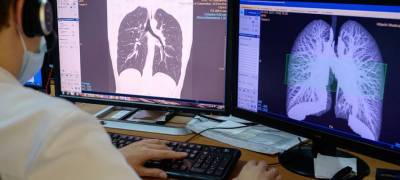 Число госпитализированных с пневмонией в Карелии за сутки увеличилось на 26 человек