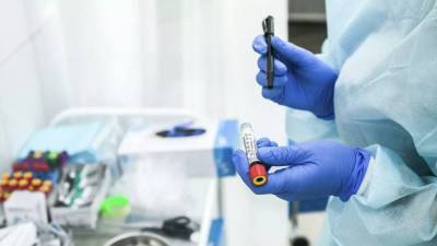 В России действует 882 лаборатории для сдачи тестов на коронавирус