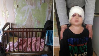 Любовник матери жестоко избил ее 3-летнего сына под Волгоградом