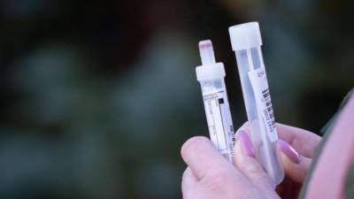 Почему немецкие медики против домашних экспресс-тестов для выявления коронавируса