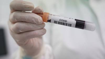 Число выявленных случаев COVID-19 в мире превысило 35 млн