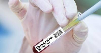 Названо количество россиян, готовых сделать прививку от коронавируса