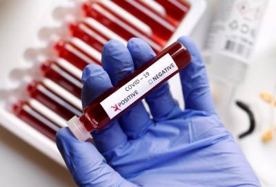 82 случая коронавируса за сутки выявили в 13 районах Ленобласти