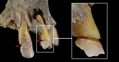 4000-летние зубы людей указали на гендерное разделение труда