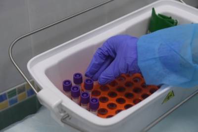 Число новых случаев коронавируса за сутки выросло в десяти регионах Поволжья