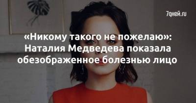 «Никому такого не пожелаю»: Наталия Медведева показала обезображенное болезнью лицо