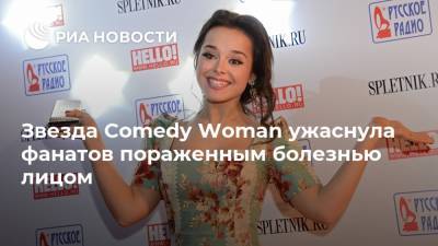 Звезда Comedy Woman ужаснула фанатов пораженным болезнью лицом