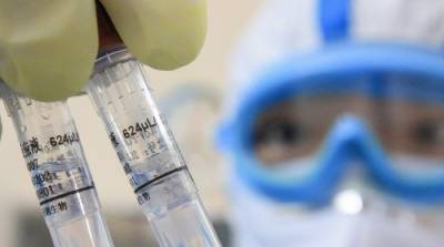 В Украине новый антирекорд по коронавирусу: 4753 больных за сутки