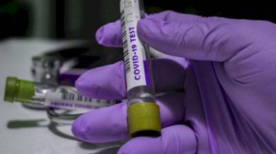В области за сутки зарегистрировали свыше 100 случаев коронавируса