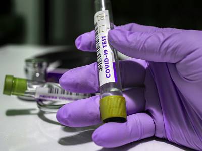 Во Франции зарегистрировано рекордное число новых случаев коронавируса за сутки