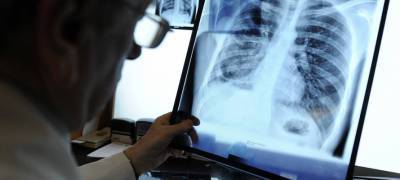 Число заболевших пневмонией в Карелии приближается к 1,5 тысячам
