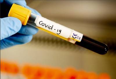 За последние сутки коронавирус нашли у еще 11,4 тыс. россиян