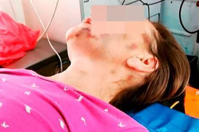 Истощенную до 35 килограммов россиянку спасли от издевавшегося над ней мужа