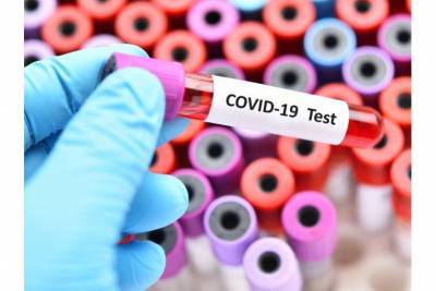 В приграничном районе Германии вводят обязательные тесты на COVID