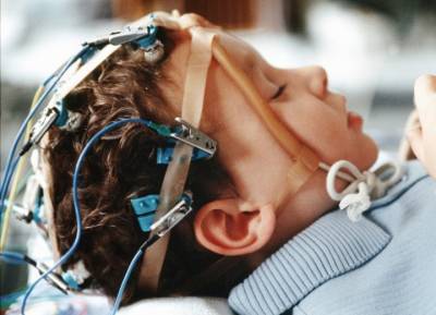 Эпилепсия у детей: как не пропустить симптомы опасной болезни и начать лечение