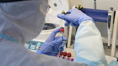 Эксперт рассказал о воздействии коронавируса на организм - russian.rt.com