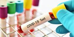 В Орловской области увеличат число тестов на COVID-19