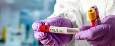 В Орловской области выявлены еще 134 заразившихся коронавирусом