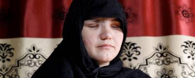 В Афганистане ослушавшейся отца девушке выкололи глаза