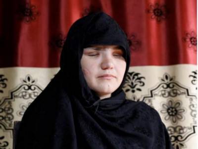 Пошла работать: в Афганистане злоумышленники лишили девушку глаз за дерзкое поведение