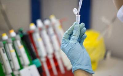 Эффективность вакцины "Спутник V" против коронавируса составила 92% - РФПИ