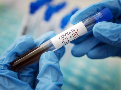 Ускорить выдачу результатов по коронавирусным тестам можно с помощью частных лабораторий - врач